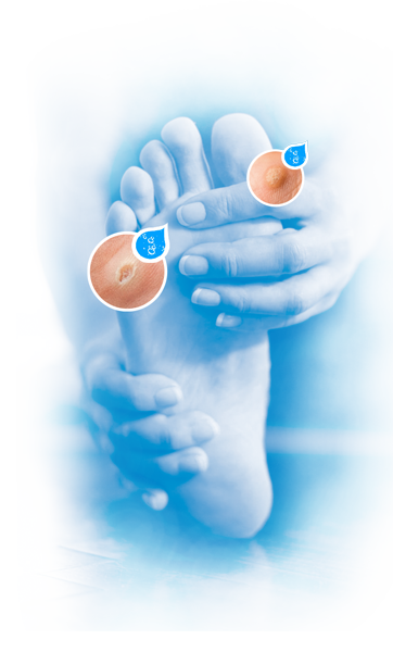 piede-verrukill-il-trattamento